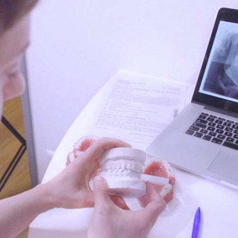 Röntgenaufnahme Gebiss