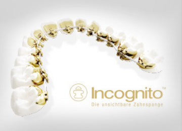 Incognito - unsichtbare Zahnspange
