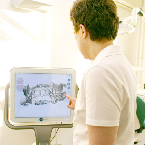 3D Intraoralscanner
