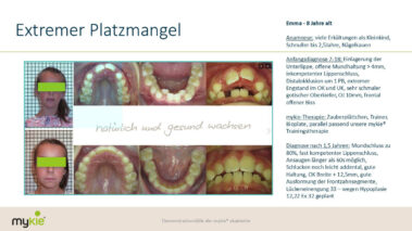 mykie fallbeispiel platzmangel